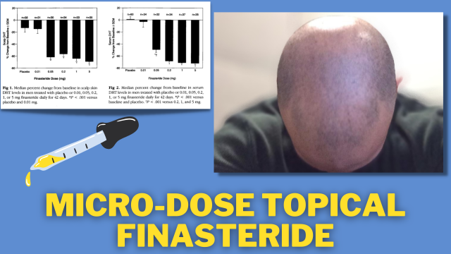 The Best Finasteride Protocol To Avoid Side Effects Micro-Dosing 