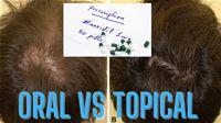 Oral Minoxidil vs Topical Minoxidil Which One is More Effective?