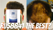 Is RU58841 The Best Topical DHT Blocker For Hair Loss