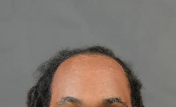 Dr. Arocha: African American Male - 2000 FUT | 8 month results
