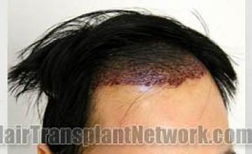 Before and after  photos