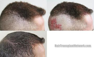  before and after images