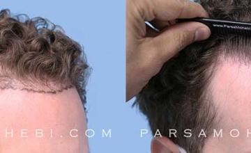 Right view of patient